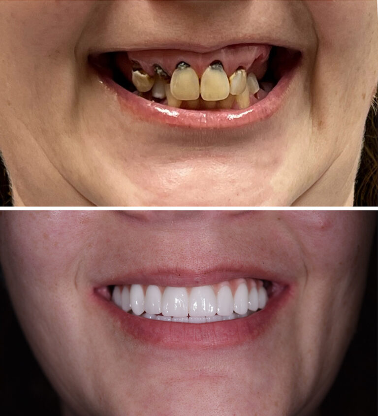 Before and After Photo 1