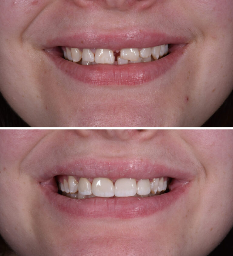 Before and After Photo 10