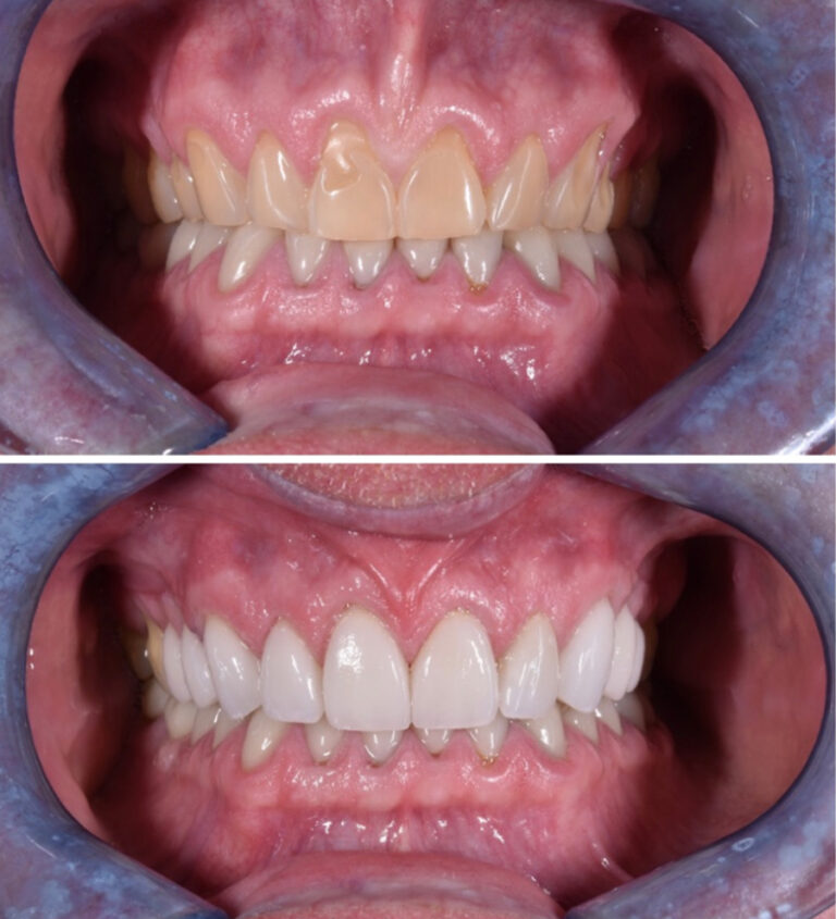 Before and After Photo 11