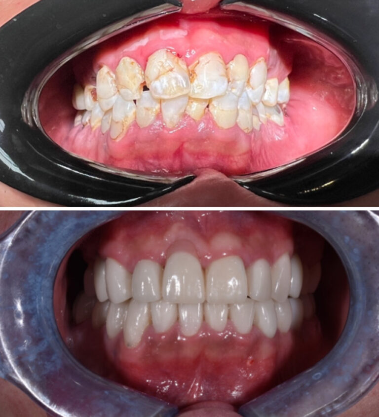 Before and After Photo 13