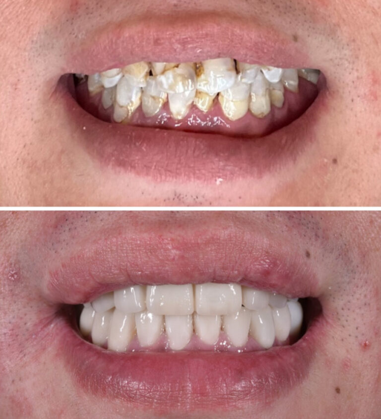 Before and After Photo 14