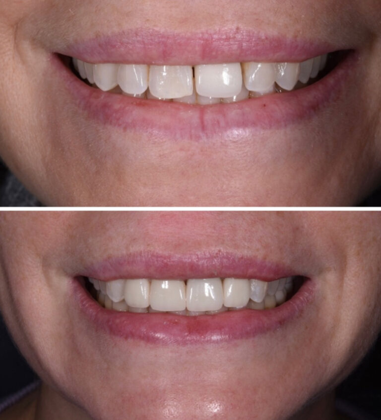 Before and After Photo 15