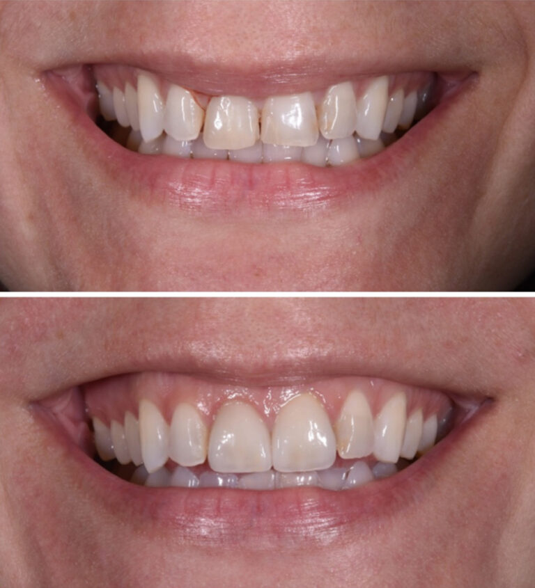 Before and After Photo 16