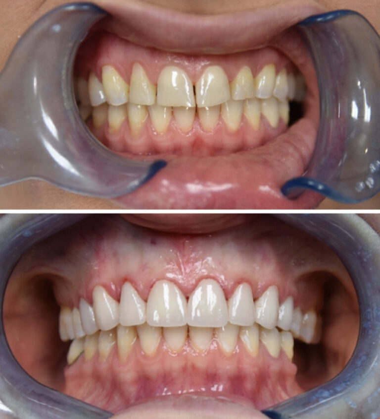 Before and After Photo 17