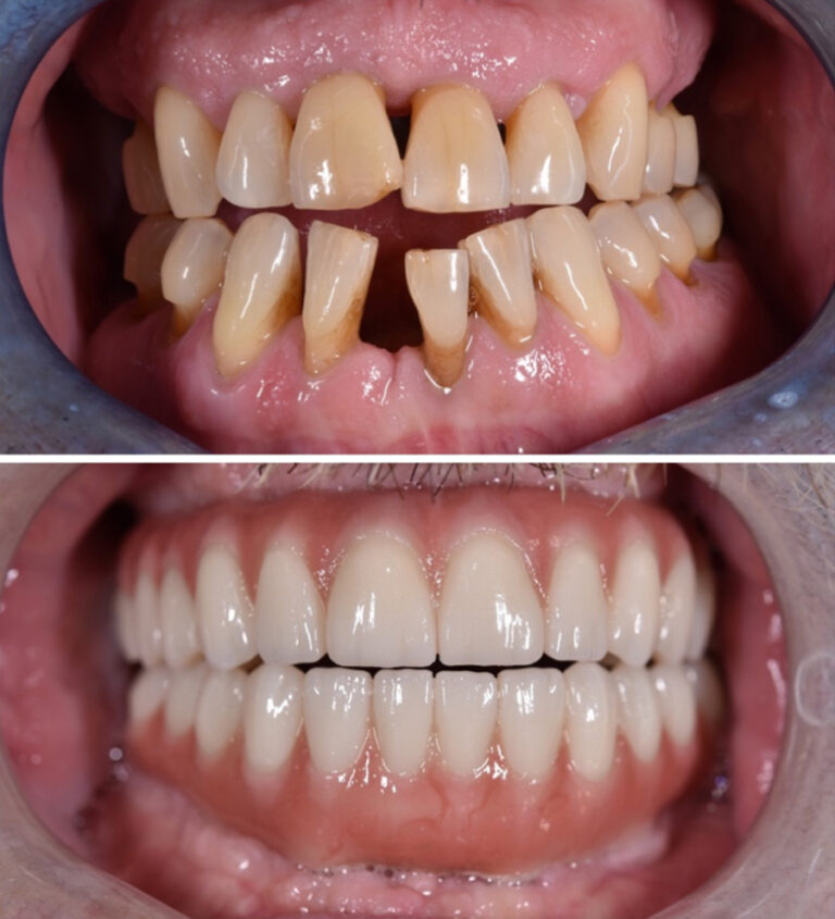 Before and After Photo 2