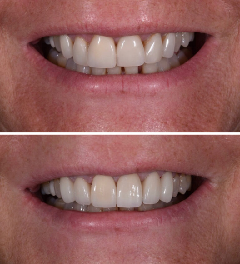 Before and After Photo 5