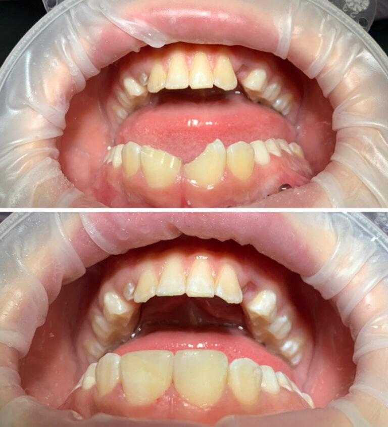 Before and After Photo 7