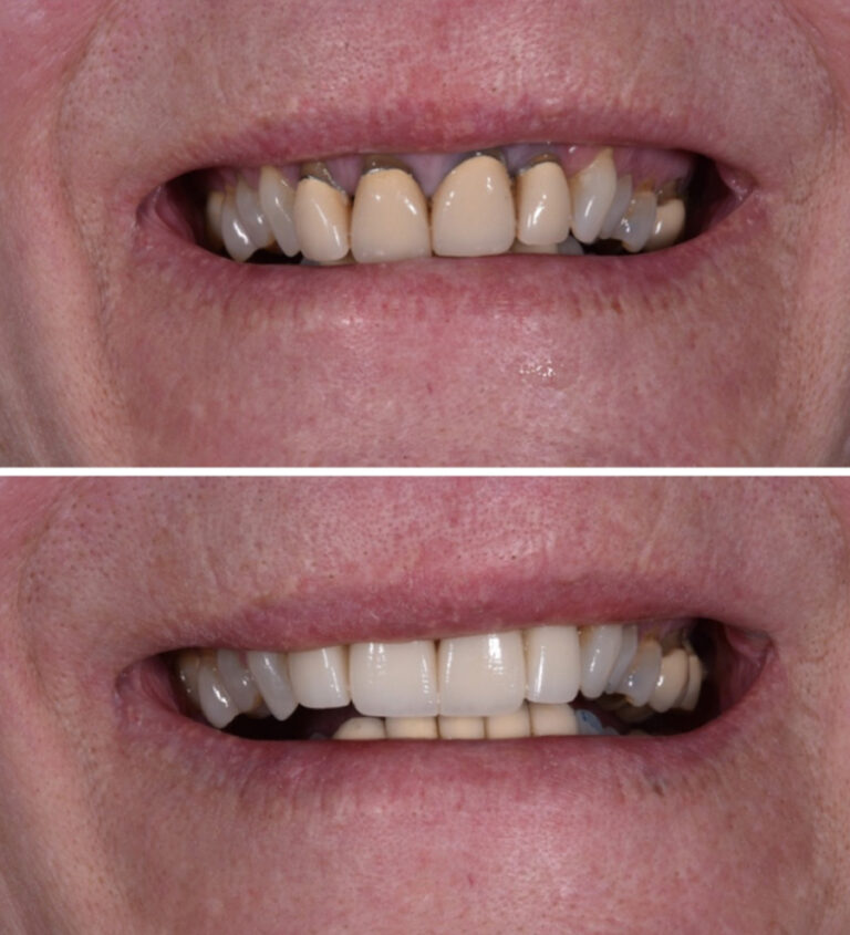 Before and After Photo 8