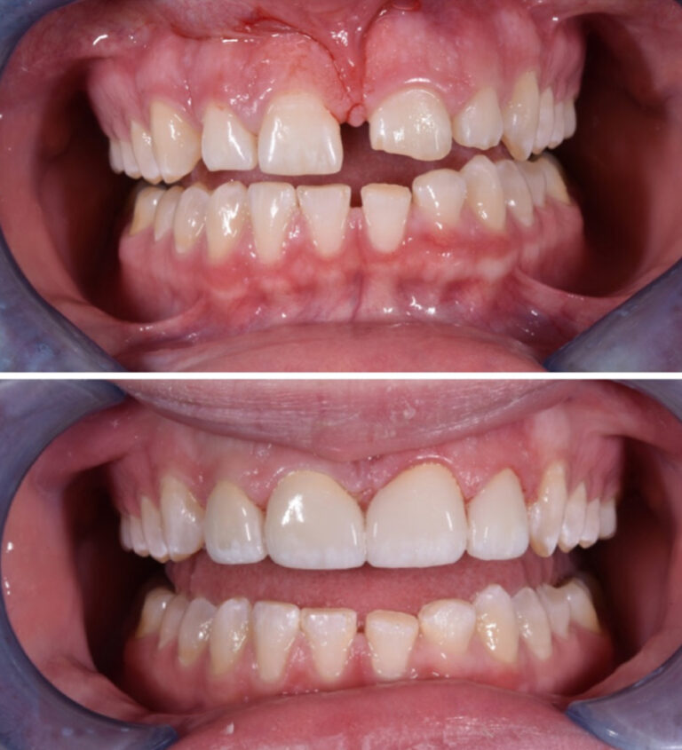 Before and After Photo 9