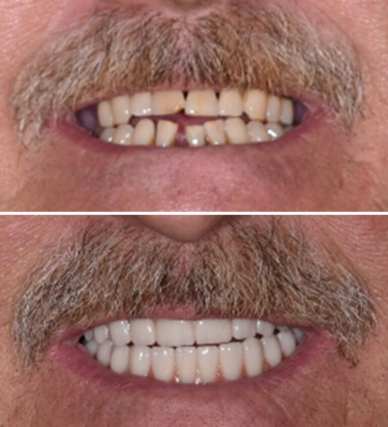 Before and After Photo 19