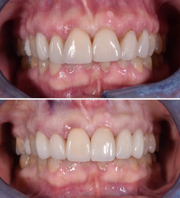 Before and After Photo 20