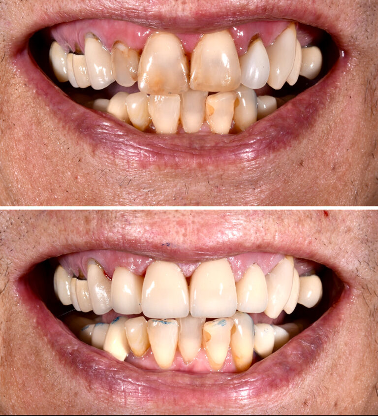 Before and After Photo 21