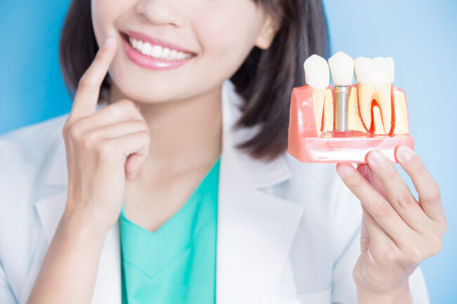 implant-tooth Woman dentist take implant tooth