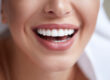Teeth Whitening