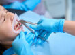 Tooth Extraction