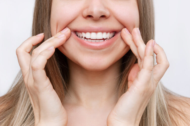 Teeth Whitening