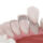 pros and cons of veneers